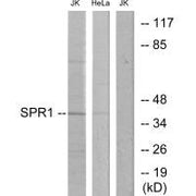 Western blot analysis of extracts from Jurkat cells and HeLa cells, using SPR1 antibody.