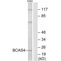 Western blot analysis of extracts from K562 cells, using BCAS4 antibody.