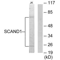 Western blot analysis of extracts from Jurkat cells, using SCAND1 antibody.