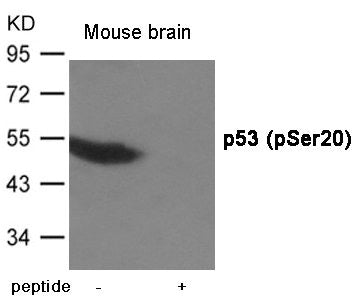 Western blot analysis of extracts from Mouse brain tissue using p53 (Phospho-Ser20) Antibody.The lane on the right is treated with the antigen-specific peptide.