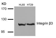 Western blot analysis of extracts from HL60 and HT29 cells using Integrin b3(Ab-785) Antibody.