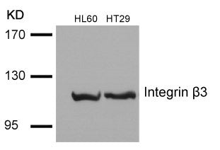 Western blot analysis of extracts from HL60 and HT29 cells using Integrin b3(Ab-785) Antibody.