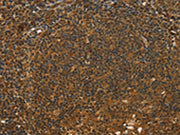 The image on the left is immunohistochemistry of paraffin-embedded Human tonsil tissue using CSB-PA226492(STAR Antibody) at dilution 1/40, on the right is treated with fusion protein. (Original magnification: ×200)