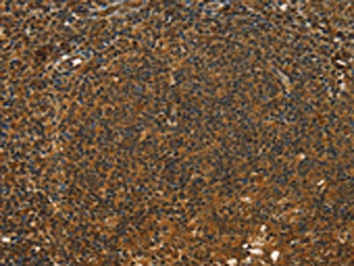 The image on the left is immunohistochemistry of paraffin-embedded Human tonsil tissue using CSB-PA226492(STAR Antibody) at dilution 1/40, on the right is treated with fusion protein. (Original magnification: ×200)