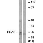 Western blot analysis of extracts from Jurkat cells, using ERAS antibody.
