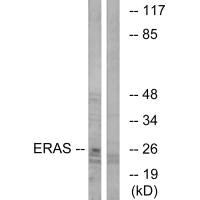 Western blot analysis of extracts from Jurkat cells, using ERAS antibody.