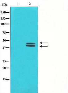 Western blot analysis on COLO205 cell lysate using ERK1/2 Antibody