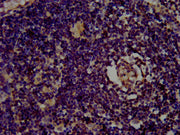 IHC image of CSB-PA22679A0Rb diluted at 1:400 and staining in paraffin-embedded human lymph node tissue performed on a Leica BondTM system. After dewaxing and hydration, antigen retrieval was mediated by high pressure in a citrate buffer (pH 6.0)....