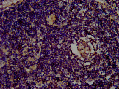 IHC image of CSB-PA22679A0Rb diluted at 1:400 and staining in paraffin-embedded human lymph node tissue performed on a Leica BondTM system. After dewaxing and hydration, antigen retrieval was mediated by high pressure in a citrate buffer (pH 6.0)....