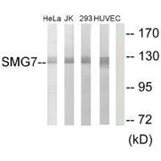 Western blot analysis of extracts from HeLa cells, Jurkat cells, 293 cells and HUVEC cells, using SMG7 antibody.