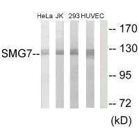 Western blot analysis of extracts from HeLa cells, Jurkat cells, 293 cells and HUVEC cells, using SMG7 antibody.