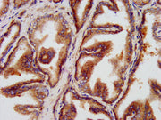 IHC image of CSB-PA22699A0Rb diluted at 1:500 and staining in paraffin-embedded human prostate tissue performed on a Leica BondTM system. After dewaxing and hydration, antigen retrieval was mediated by high pressure in a citrate buffer (pH 6.0). S...