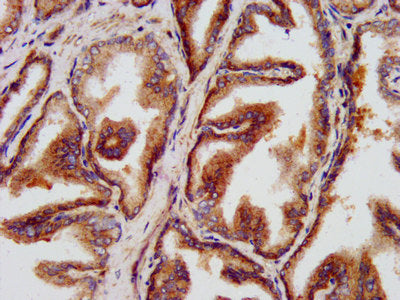 IHC image of CSB-PA22699A0Rb diluted at 1:500 and staining in paraffin-embedded human prostate tissue performed on a Leica BondTM system. After dewaxing and hydration, antigen retrieval was mediated by high pressure in a citrate buffer (pH 6.0). S...