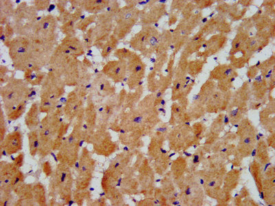 IHC image of CSB-PA22719A0Rb diluted at 1:300 and staining in paraffin-embedded human heart tissue performed on a Leica BondTM system. After dewaxing and hydration, antigen retrieval was mediated by high pressure in a citrate buffer (pH 6.0). Sect...
