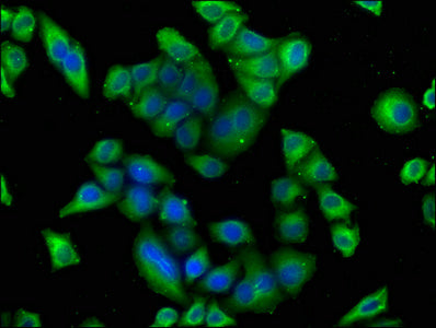 Immunofluorescence staining of Hela cells with CSB-PA22749A0Rb at 1:100, counter-stained with DAPI. The cells were fixed in 4% formaldehyde, permeabilized using 0.2% Triton X-100 and blocked in 10% normal Goat Serum. The cells were then incubated...