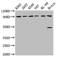 Western Blot Positive WB detected in: K562 whole cell lysate, 293T whole cell lysate, A549 whole cell lysate, U87 whole cell lysate, HL60 whole cell lysate, Rat brain tissue All lanes: OCA2 antibody at 8.93µg/ml Secondary Goat polyclonal to rabbit...