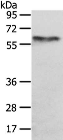 Gel: 6%SDS-PAGE, Lysate: 40 ug, Lane: A431 cell, Primary antibody: CSB-PA227642(UGT1A10 Antibody) at dilution 1/250 dilution, Secondary antibody: Goat anti rabbit IgG at 1/8000 dilution, Exposure time: 10 seconds