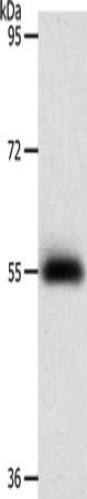 Gel: 8%SDS-PAGE, Lysate: 40 ug, Lane: Human liver cancer tissue, Primary antibody: CSB-PA228254(PRKAA1 Antibody) at dilution 1/800, Secondary antibody: Goat anti rabbit IgG at 1/8000 dilution, Exposure time: 2 minutes