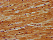 IHC image of CSB-PA22849A0Rb diluted at 1:300 and staining in paraffin-embedded human heart tissue performed on a Leica BondTM system. After dewaxing and hydration, antigen retrieval was mediated by high pressure in a citrate buffer (pH 6.0). Sect...
