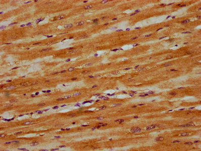 IHC image of CSB-PA22849A0Rb diluted at 1:300 and staining in paraffin-embedded human heart tissue performed on a Leica BondTM system. After dewaxing and hydration, antigen retrieval was mediated by high pressure in a citrate buffer (pH 6.0). Sect...