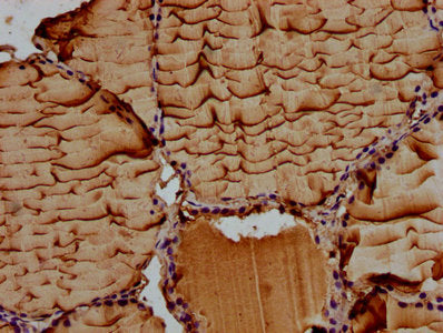 IHC image of CSB-PA22869A0Rb diluted at 1:100 and staining in paraffin-embedded human thyroid tissue performed on a Leica BondTM system. After dewaxing and hydration, antigen retrieval was mediated by high pressure in a citrate buffer (pH 6.0). Se...