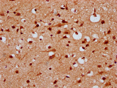 IHC image of CSB-PA22879A0Rb diluted at 1:300 and staining in paraffin-embedded human brain tissue performed on a Leica BondTM system. After dewaxing and hydration, antigen retrieval was mediated by high pressure in a citrate buffer (pH 6.0). Sect...