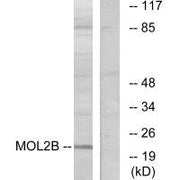 Western blot analysis of extracts from COLO cells, using MOL2B antibody.