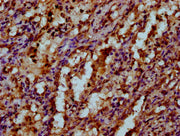 IHC image of CSB-PA22899A0Rb diluted at 1:200 and staining in paraffin-embedded human lung tissue performed on a Leica BondTM system. After dewaxing and hydration, antigen retrieval was mediated by high pressure in a citrate buffer (pH 6.0). Secti...