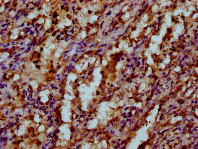 IHC image of CSB-PA22899A0Rb diluted at 1:200 and staining in paraffin-embedded human lung tissue performed on a Leica BondTM system. After dewaxing and hydration, antigen retrieval was mediated by high pressure in a citrate buffer (pH 6.0). Secti...