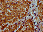 IHC image of CSB-PA22919A0Rb diluted at 1:200 and staining in paraffin-embedded human liver tissue performed on a Leica BondTM system. After dewaxing and hydration, antigen retrieval was mediated by high pressure in a citrate buffer (pH 6.0). Sect...