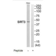 Western blot analysis of extracts from COLO205 cells, using SIRT3 antibody.
