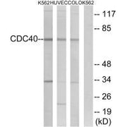 Western blot analysis of extracts from K562 cells, HUVEC cells and COLO cells, using CDC40 antibody.
