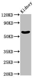Western Blot Positive WB detected in: Mouse kidney tissue All lanes: MGAT3 antibody at 2.35ug/ml Secondary Goat polyclonal to rabbit IgG at 1/50000 dilution Predicted band size: 62 kDa Observed band size: 62 kDa