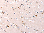 The image on the left is immunohistochemistry of paraffin-embedded Human brain tissue using CSB-PA230308(RalA Antibody) at dilution 1/20, on the right is treated with synthetic peptide. (Original magnification: ×200)