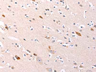 The image on the left is immunohistochemistry of paraffin-embedded Human brain tissue using CSB-PA230308(RalA Antibody) at dilution 1/20, on the right is treated with synthetic peptide. (Original magnification: ×200)