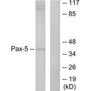 Western blot analysis of extracts from 293 cells, using Pax-5 antibody.