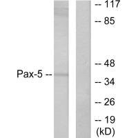 Western blot analysis of extracts from 293 cells, using Pax-5 antibody.