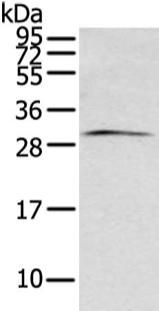 Gel: 12%SDS-PAGE, Lysate: 40 ug, Lane: Mouse brain tissue, Primary antibody: CSB-PA230604(ZFAND2B Antibody) at dilution 1/200 dilution, Secondary antibody: Goat anti rabbit IgG at 1/8000 dilution, Exposure time: 1 minute