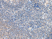 The image on the left is immunohistochemistry of paraffin-embedded Human tonsil tissue using CSB-PA230617(GRB14 Antibody) at dilution 1/20, on the right is treated with fusion protein. (Original magnification: ×200)