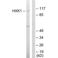 Western blot analysis of extracts from HeLa cells, using HXK1 antibody.