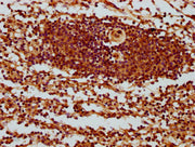 IHC image of CSB-PA23069A0Rb diluted at 1:400 and staining in paraffin-embedded human spleen tissue performed on a Leica BondTM system. After dewaxing and hydration, antigen retrieval was mediated by high pressure in a citrate buffer (pH 6.0). Sec...