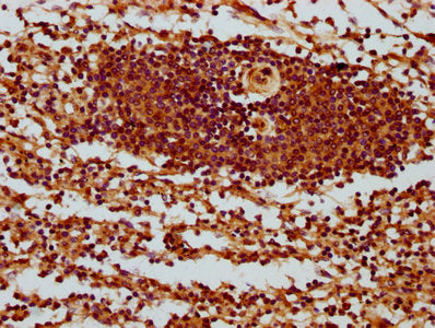 IHC image of CSB-PA23069A0Rb diluted at 1:400 and staining in paraffin-embedded human spleen tissue performed on a Leica BondTM system. After dewaxing and hydration, antigen retrieval was mediated by high pressure in a citrate buffer (pH 6.0). Sec...