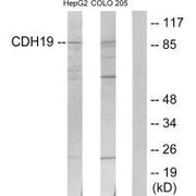 Western blot analysis of extracts from HepG2 cells and COLO205 cells, using CDH19 antibody.