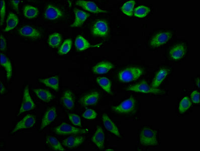 Immunofluorescence staining of A549 cells with CSB-PA23079A0Rb at 1:166, counter-stained with DAPI. The cells were fixed in 4% formaldehyde, permeabilized using 0.2% Triton X-100 and blocked in 10% normal Goat Serum. The cells were then incubated...
