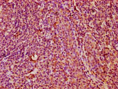 IHC image of CSB-PA23099A0Rb diluted at 1:400 and staining in paraffin-embedded human tonsil tissue performed on a Leica BondTM system. After dewaxing and hydration, antigen retrieval was mediated by high pressure in a citrate buffer (pH 6.0). Sec...
