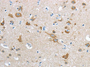 The image on the left is immunohistochemistry of paraffin-embedded Human brain tissue using CSB-PA231041(HCN4 Antibody) at dilution 1/20, on the right is treated with synthetic peptide. (Original magnification: ×200)