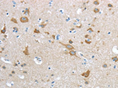 The image on the left is immunohistochemistry of paraffin-embedded Human brain tissue using CSB-PA231041(HCN4 Antibody) at dilution 1/20, on the right is treated with synthetic peptide. (Original magnification: ×200)