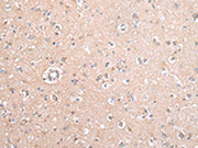 The image on the left is immunohistochemistry of paraffin-embedded Human brain tissue using CSB-PA231151(GJB5 Antibody) at dilution 1/45, on the right is treated with synthetic peptide. (Original magnification: ×200)
