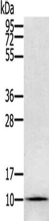 Gel: 12%SDS-PAGE, Lysate: 40 ug, Lane: Hela cells, Primary antibody: CSB-PA231197(GLRX Antibody) at dilution 1/800, Secondary antibody: Goat anti rabbit IgG at 1/8000 dilution, Exposure time: 1 minute