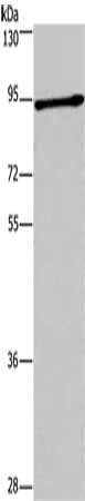 Gel: 6%SDS-PAGE, Lysate: 40 ug, Lane: Mouse brain tissue, Primary antibody: CSB-PA231221(DCLK1 Antibody) at dilution 1/200, Secondary antibody: Goat anti rabbit IgG at 1/8000 dilution, Exposure time: 10 minutes